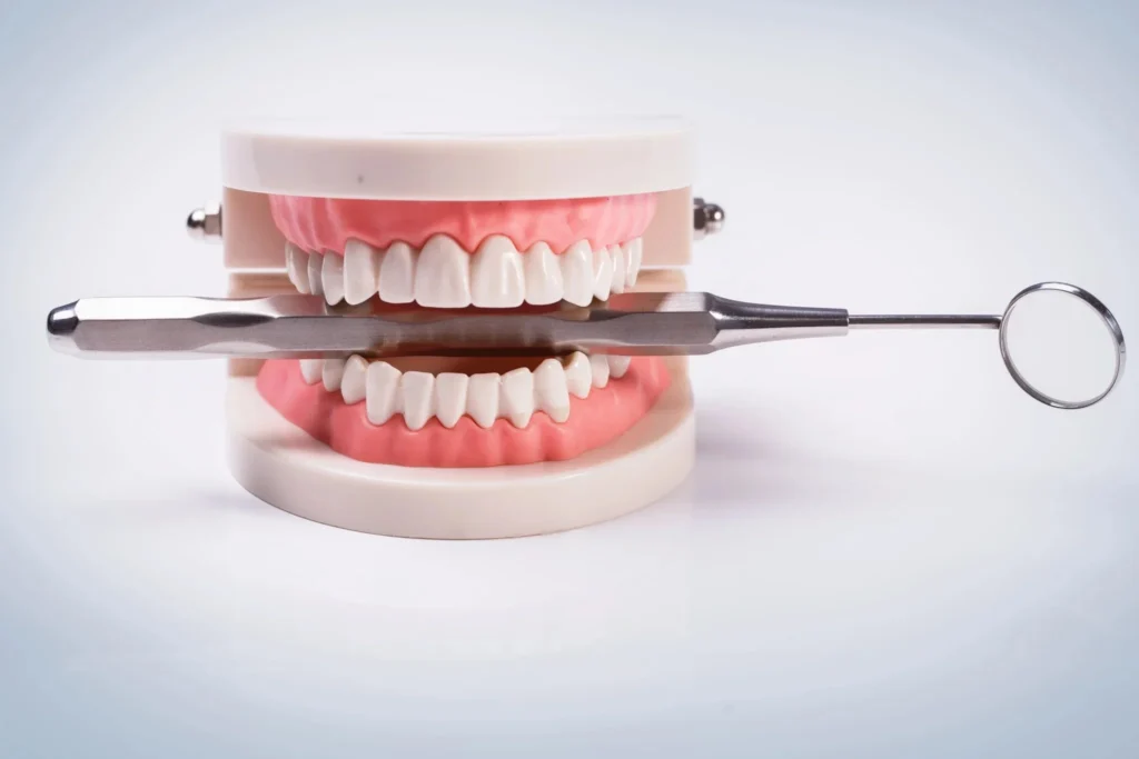 Cuanto cuestan los implantes dentales 