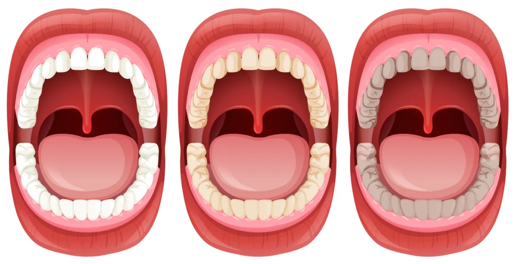 how much are dental implants